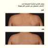 1-1-4.png Salicylic Acid 0.5% Body Serum