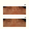 2-2-1.png Niacinamide 5% Face and Body Emulsion