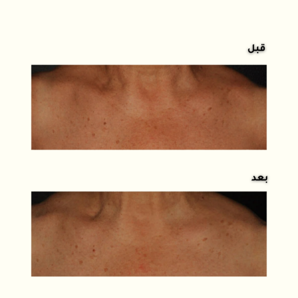 2-2-1.png Niacinamide 5% Face and Body Emulsion