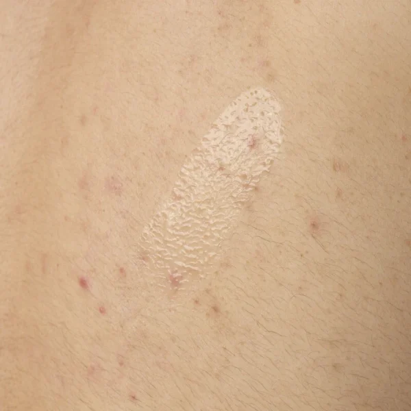 ORD-salicylic-acid-05-body-240ml-application.webp Salicylic Acid 0.5% Body Serum
