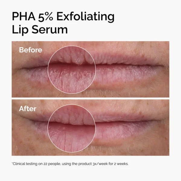 ord-pha-5pct-lip-exfoliating-serum-before-after PHA 5% Exfoliating Lip Serum