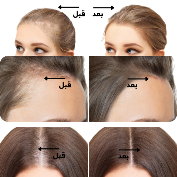 ترطيب-18.png Multi-Peptide Serum for Hair Density